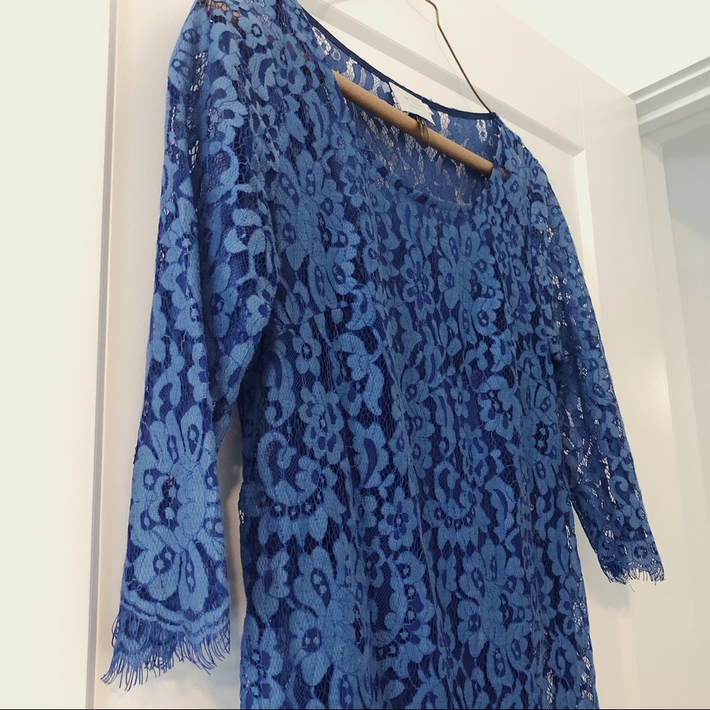 ANTHROPOLOGIE LACE DRESS